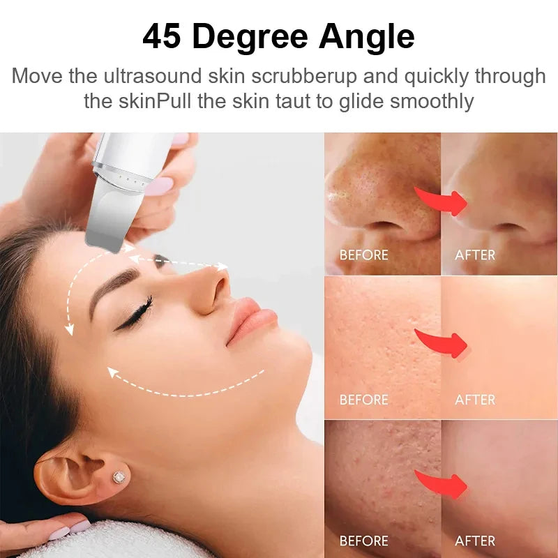 JullieTette - Skin Facial Scrubber
