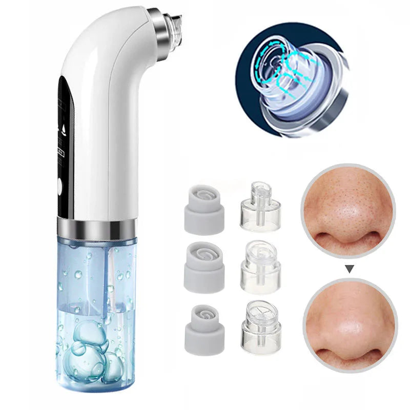 JullieTette - Bubble Electric Blackhead Remover